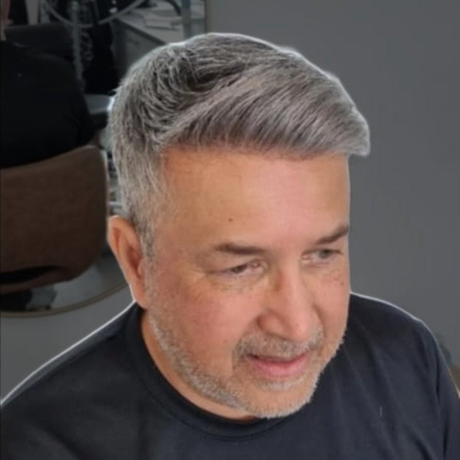 Close-up of a client's hairline after their Tuffs hair system