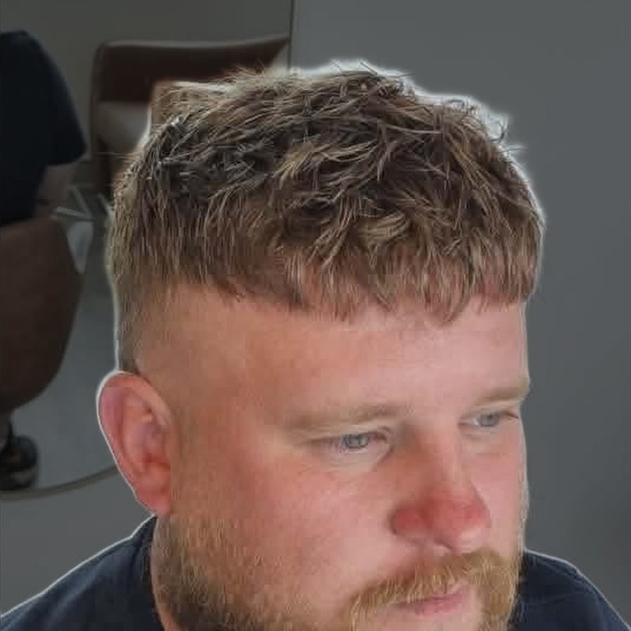 Close-up of a client's hairline after their Tuffs hair system